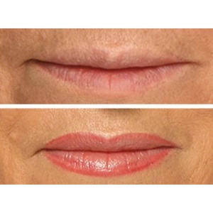 Dermopigmentación de labios también conocida como maquillaje permanente